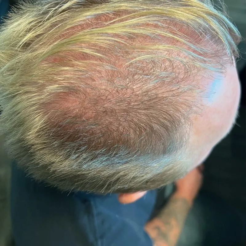 Before treatment